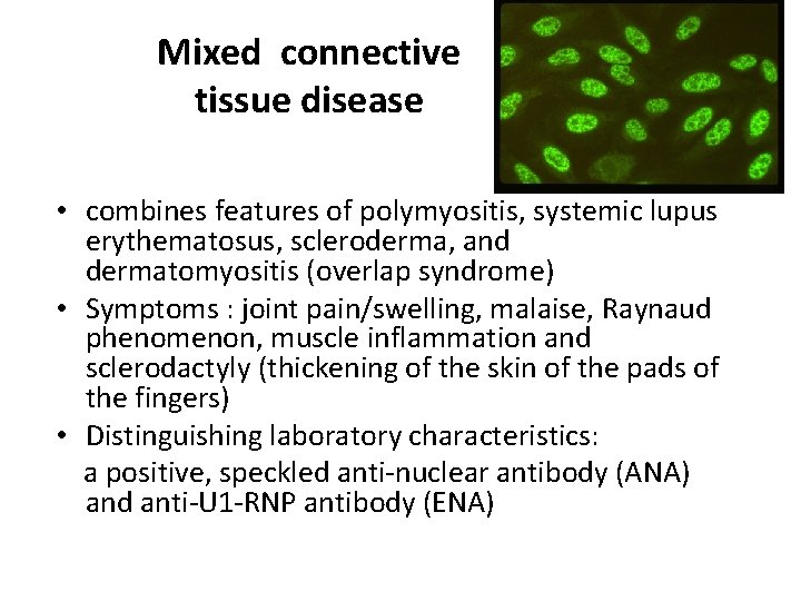 Mixed connective tissue disease • combines features of polymyositis, systemic lupus erythematosus, scleroderma, and