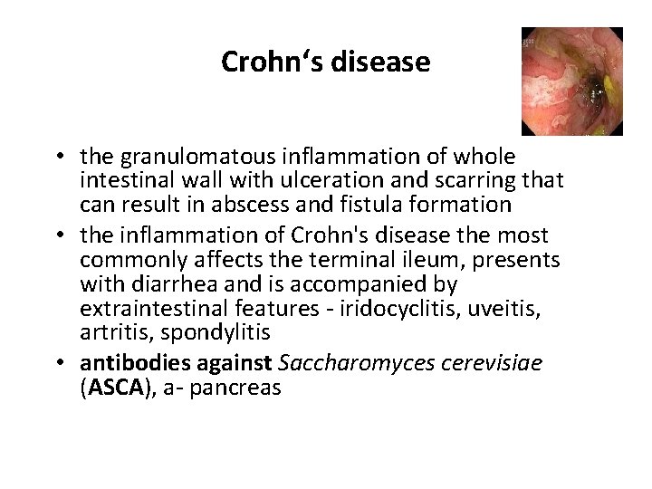 Crohn‘s disease • the granulomatous inflammation of whole intestinal wall with ulceration and scarring