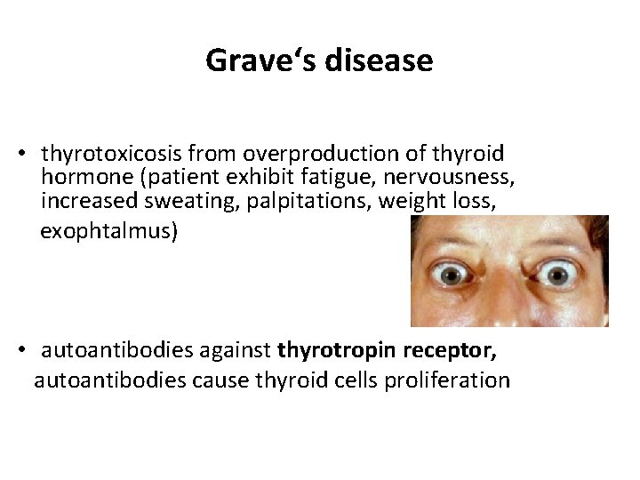 Grave‘s disease • thyrotoxicosis from overproduction of thyroid hormone (patient exhibit fatigue, nervousness, increased