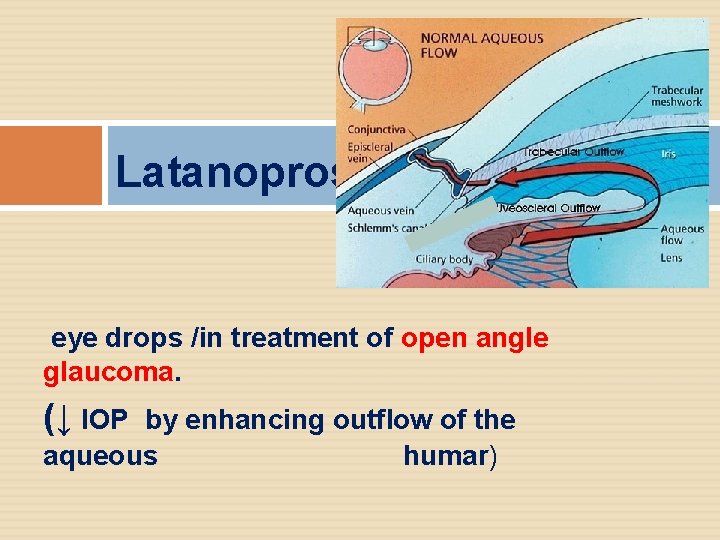 Latanoprost eye drops /in treatment of open angle glaucoma. (↓ IOP by enhancing outflow