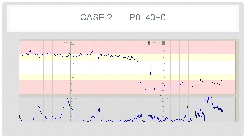 CASE 2. P 0 40+0 CASE 2. P 0 40+0