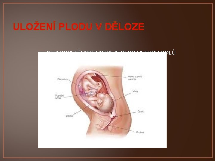 ULOŽENÍ PLODU V DĚLOZE KE KONCI TĚHOTENSTVÍ JE PLOD HLAVOU DOLŮ 