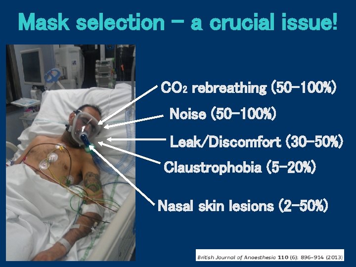Mask selection - a crucial issue! CO 2 rebreathing (50 -100%) Noise (50 -100%)