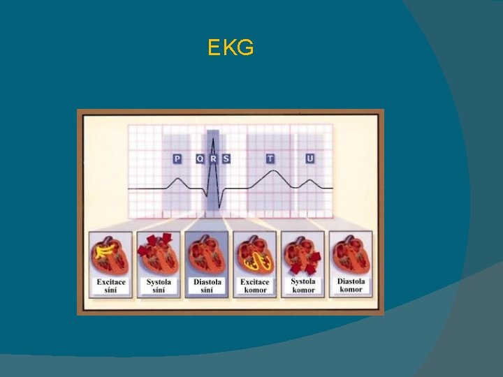 EKG 