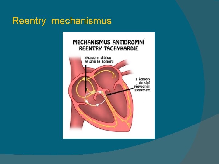 Reentry mechanismus 