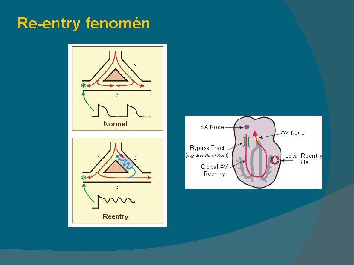 Re-entry fenomén 