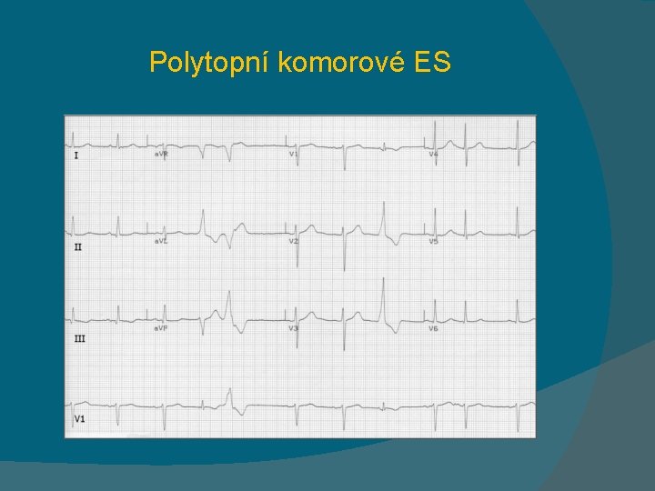 Polytopní komorové ES 