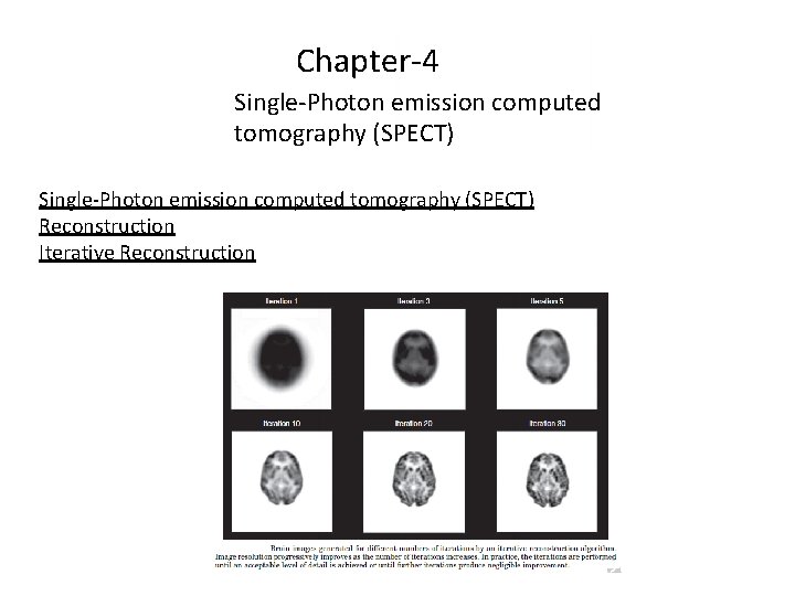 Chapter-4 Single-Photon emission computed tomography (SPECT) Reconstruction Iterative Reconstruction 