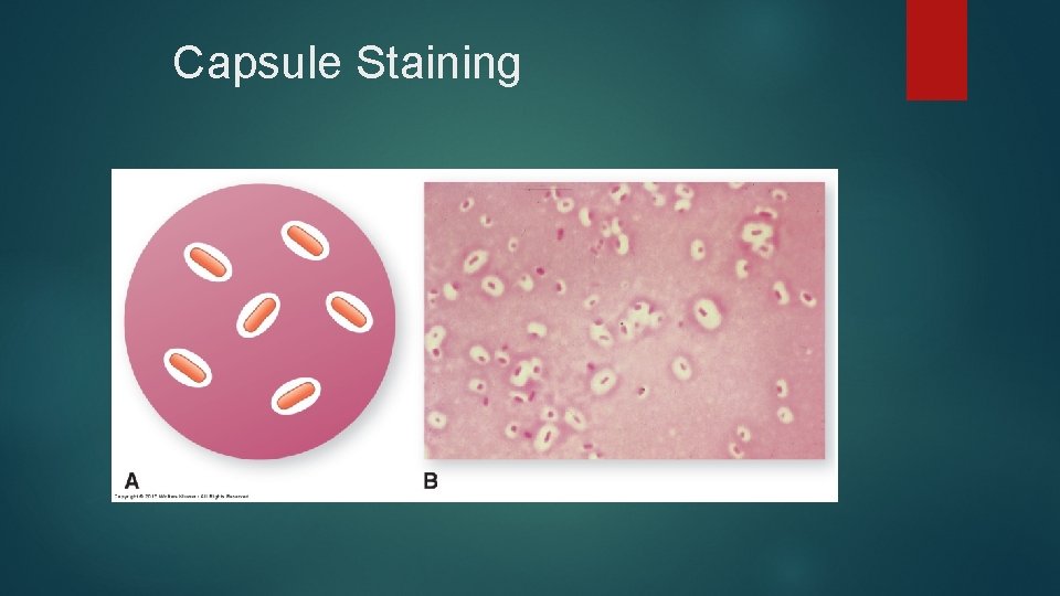 Capsule Staining 