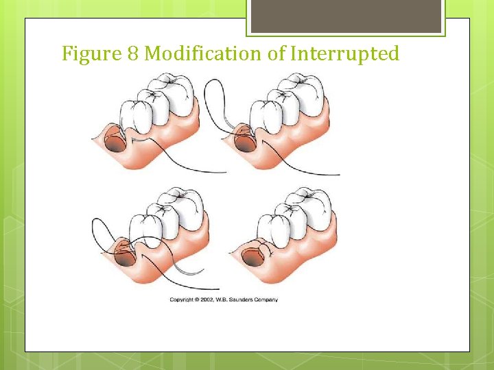 Figure 8 Modification of Interrupted 