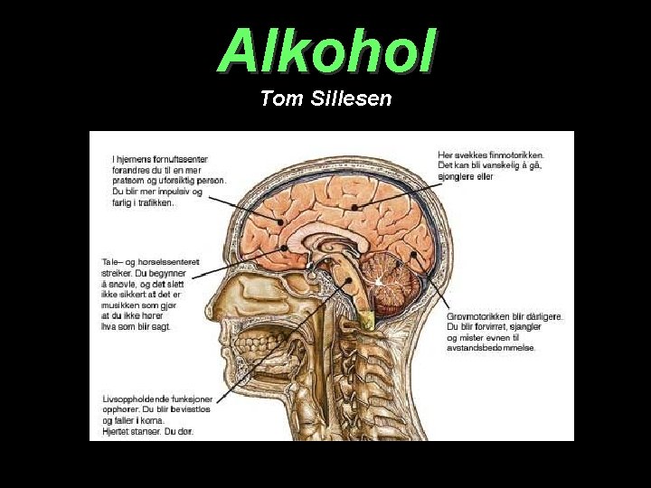 Alkohol Tom Sillesen 