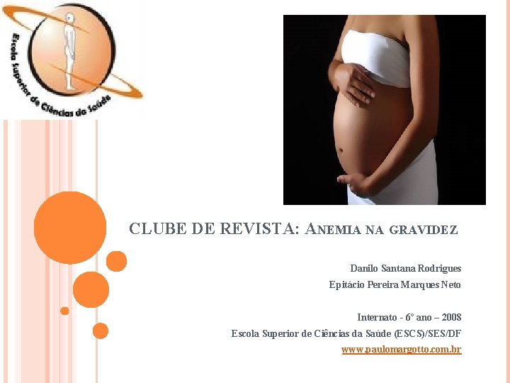 CLUBE DE REVISTA: ANEMIA NA GRAVIDEZ Danilo Santana Rodrigues Epitácio Pereira Marques Neto Internato