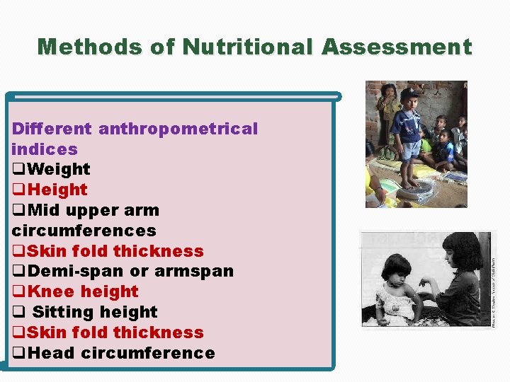 Methods of Nutritional Assessment Different anthropometrical indices q. Weight q. Height q. Mid upper