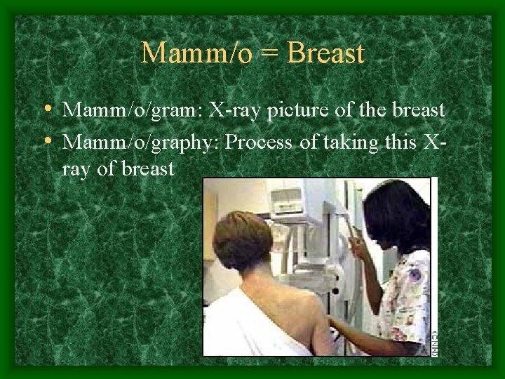 Mamm/o = Breast • Mamm/o/gram: X-ray picture of the breast • Mamm/o/graphy: Process of