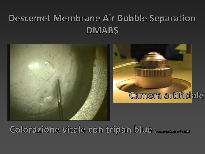 Descemet Membrane Air Bubble Separation DMABS Camera artificiale Colorazione vitale con tripan blue (conservazione