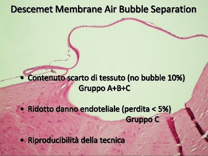 Descemet Membrane Air Bubble Separation • Contenuto scarto di tessuto (no bubble 10%) Gruppo