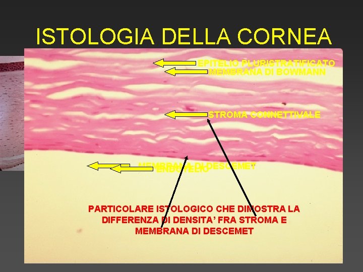 ISTOLOGIA DELLA CORNEA EPITELIO PLURISTRATIFICATO MEMBRANA DI BOWMANN STROMA CONNETTIVALE MEMBRANA DI DESCEMET ENDOTELIO