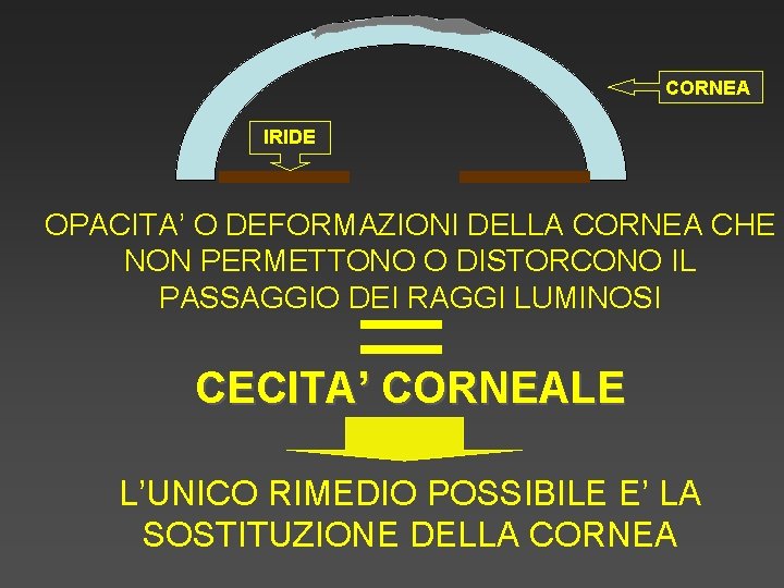 CORNEA IRIDE OPACITA’ O DEFORMAZIONI DELLA CORNEA CHE NON PERMETTONO O DISTORCONO IL PASSAGGIO