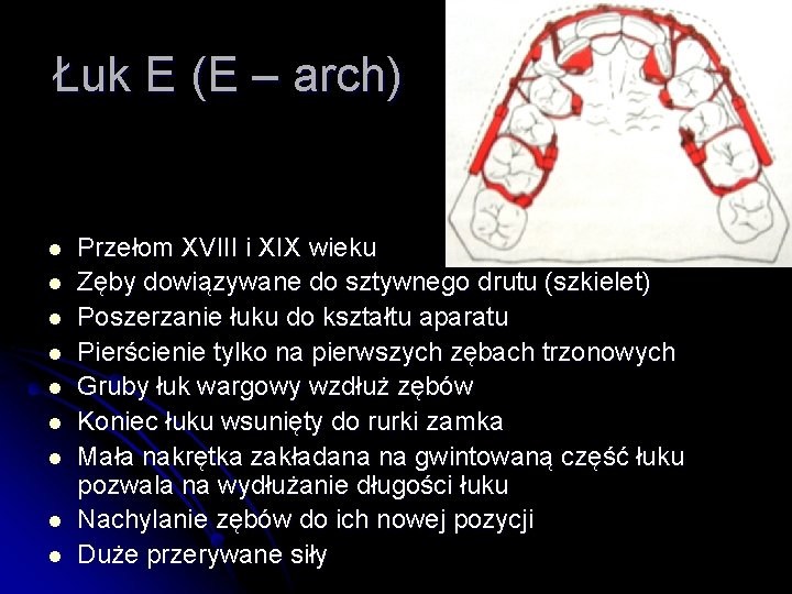 Łuk E (E – arch) l l l l l Przełom XVIII i XIX