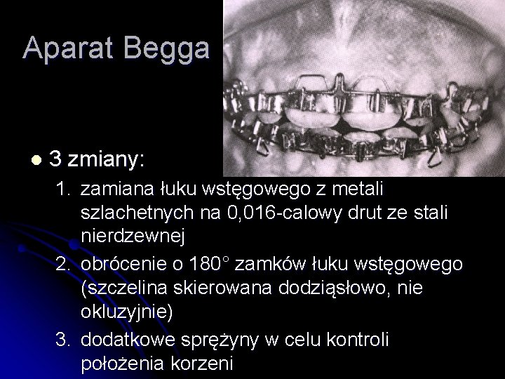 Aparat Begga l 3 zmiany: 1. zamiana łuku wstęgowego z metali szlachetnych na 0,