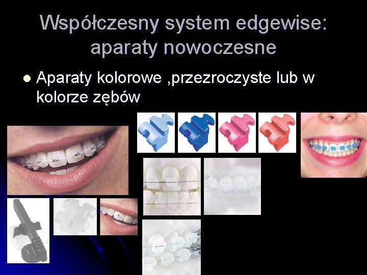 Współczesny system edgewise: aparaty nowoczesne l Aparaty kolorowe , przezroczyste lub w kolorze zębów