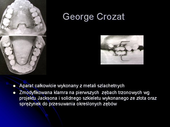 George Crozat l l Aparat całkowicie wykonany z metali szlachetnych Zmodyfikowana klamra na pierwszych