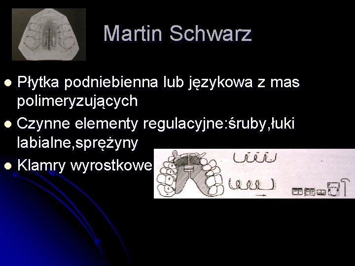 Martin Schwarz Płytka podniebienna lub językowa z mas polimeryzujących l Czynne elementy regulacyjne: śruby,