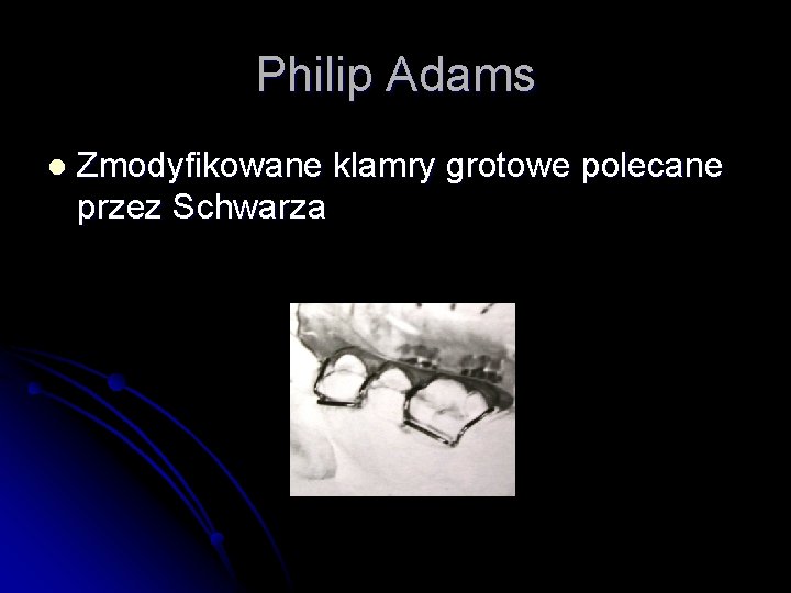 Philip Adams l Zmodyfikowane klamry grotowe polecane przez Schwarza 