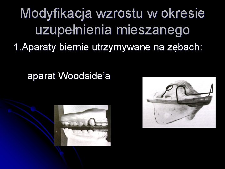 Modyfikacja wzrostu w okresie uzupełnienia mieszanego 1. Aparaty biernie utrzymywane na zębach: aparat Woodside’a