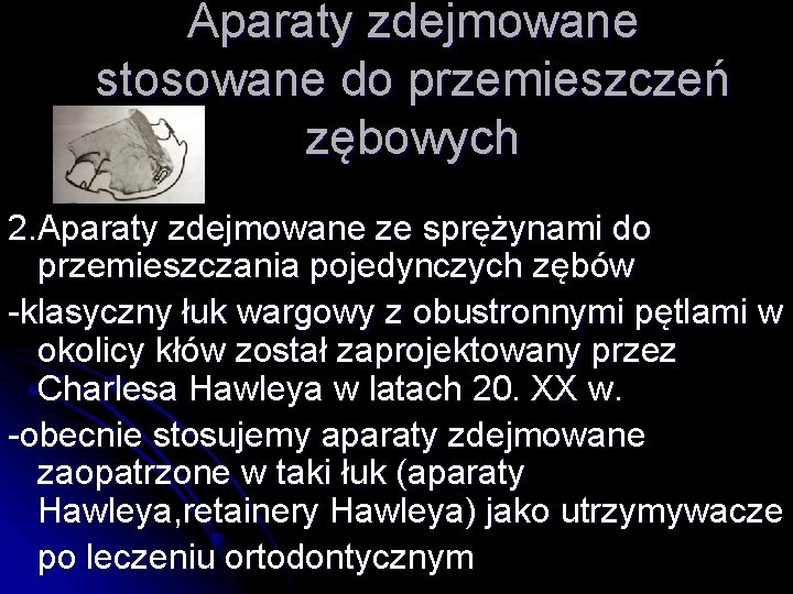 Aparaty zdejmowane stosowane do przemieszczeń zębowych 2. Aparaty zdejmowane ze sprężynami do przemieszczania pojedynczych