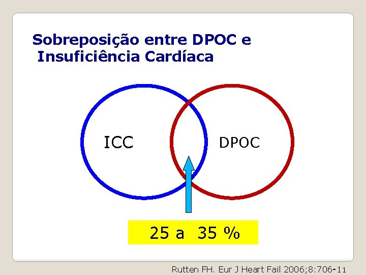 Sobreposição entre DPOC e Insuficiência Cardíaca ICC DPOC 25 a 35 % Rutten FH.