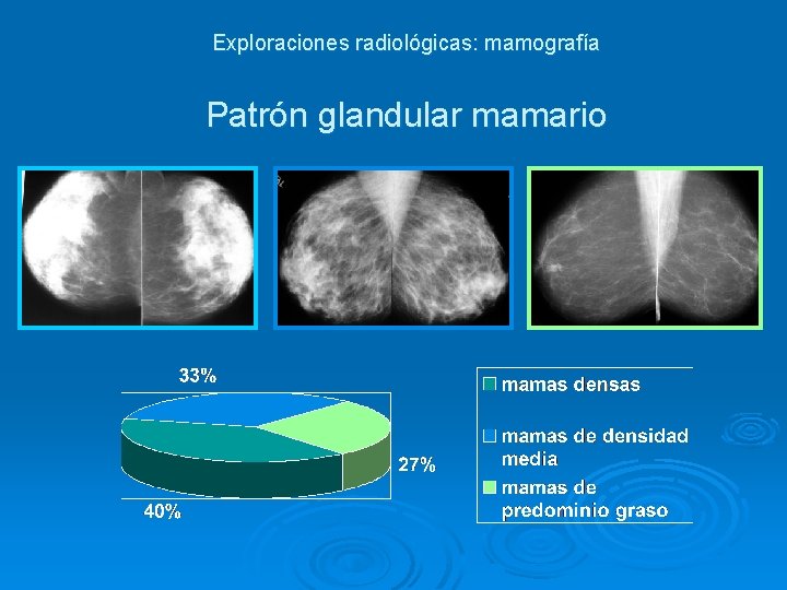 Exploraciones radiológicas: mamografía Patrón glandular mamario Exploraciones radiológicas: mamografía Patrón glandular mamario