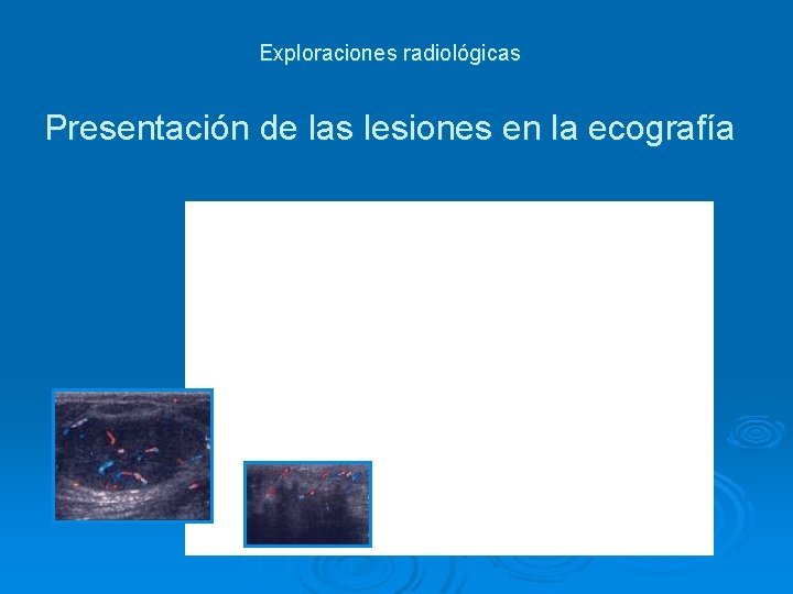 Exploraciones radiológicas Presentación de las lesiones en la ecografía Exploraciones radiológicas Presentación de las lesiones en la ecografía
