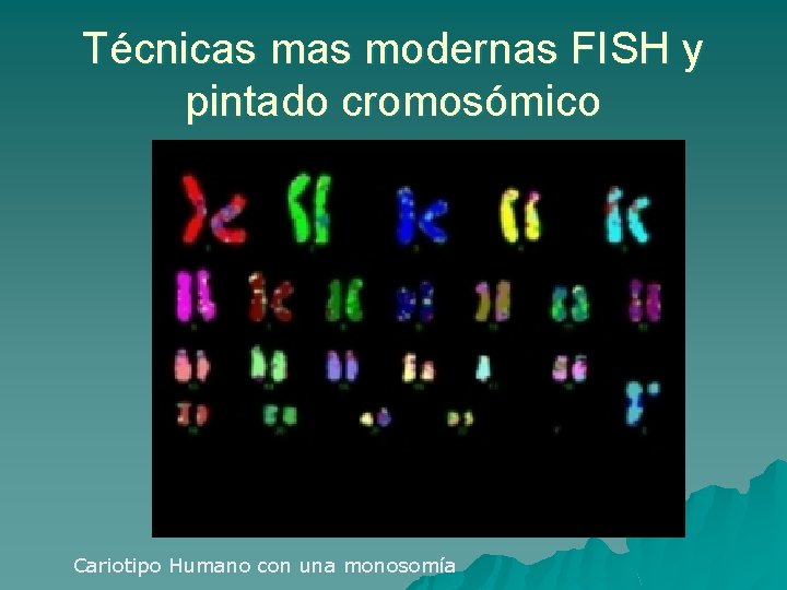 Técnicas modernas FISH y pintado cromosómico Cariotipo Humano con una monosomía 