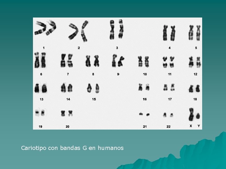 Cariotipo con bandas G en humanos 