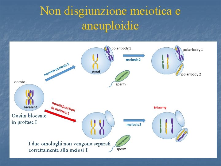 Non disgiunzione meiotica e aneuploidie Oocita bloccato in profase I I due omologhi non
