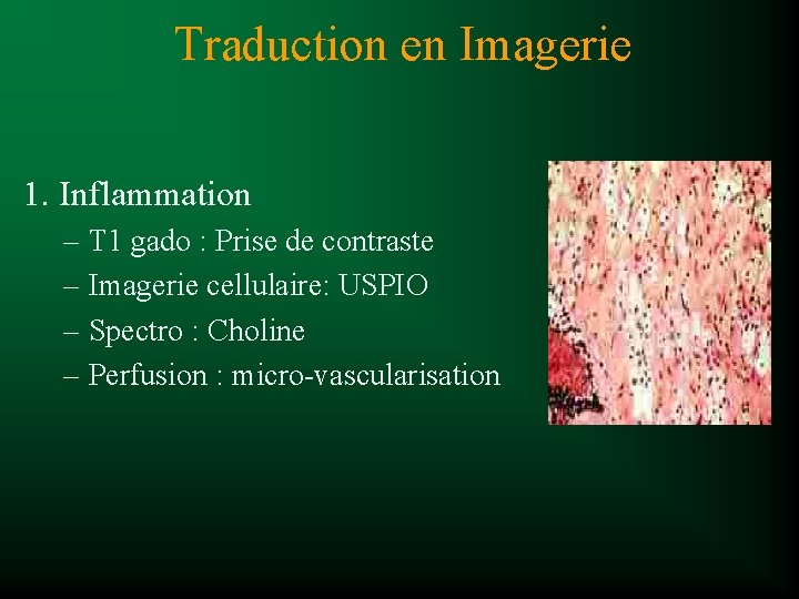 Traduction en Imagerie 1. Inflammation – T 1 gado : Prise de contraste –