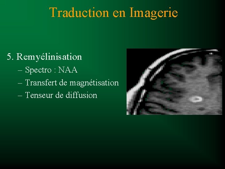Traduction en Imagerie 5. Remyélinisation – Spectro : NAA – Transfert de magnétisation –