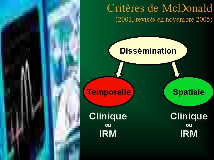 Comment poser le diagnostic de SEP ? Critères de Mc. Donald (2001, révisés en