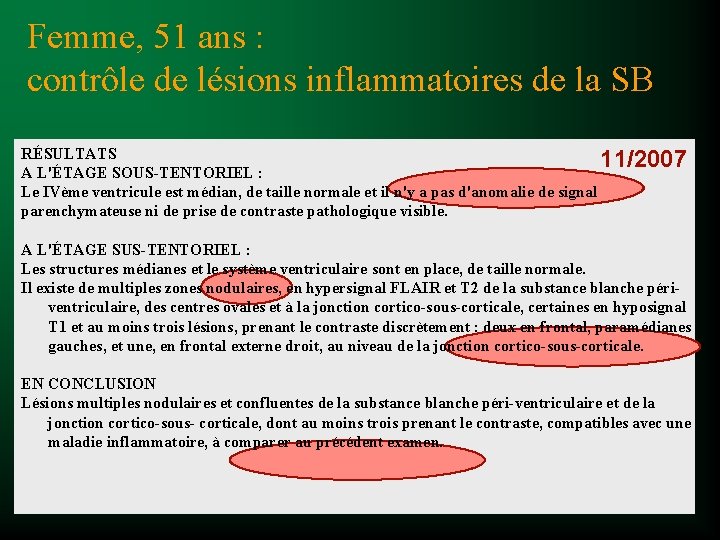 Femme, 51 ans : contrôle de lésions inflammatoires de la SB RÉSULTATS 11/2007 A