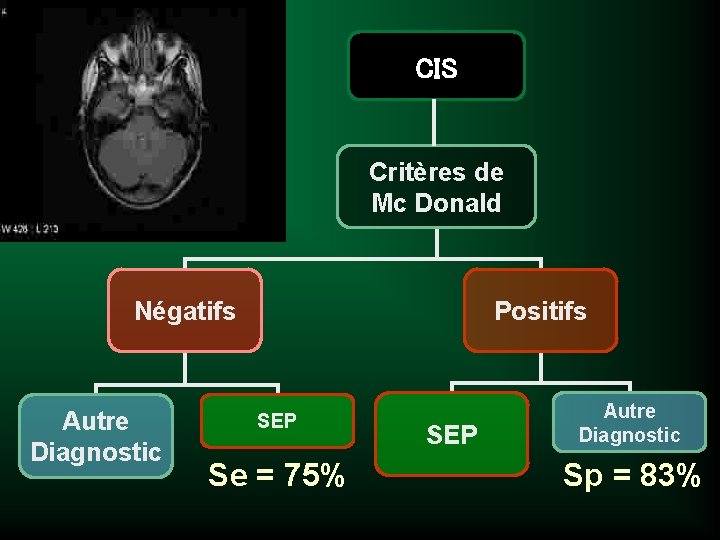 CIS Critères de Mc Donald Négatifs Autre Diagnostic Positifs SEP Se = 75% SEP