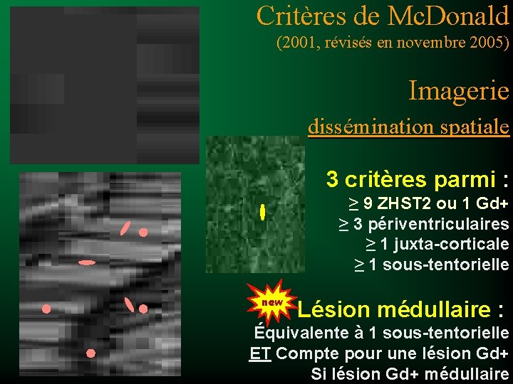 Critères de Mc. Donald (2001, révisés en novembre 2005) Imagerie dissémination spatiale 3 critères