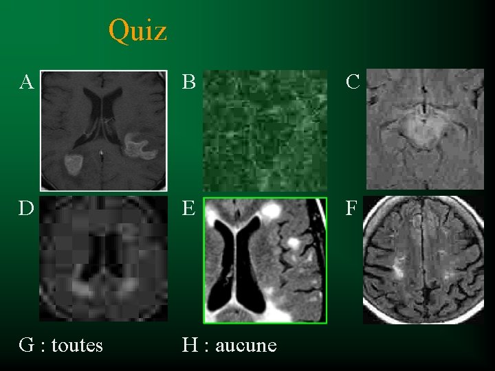 Quiz A B C D E F G : toutes H : aucune 