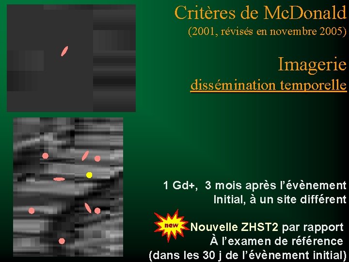 Critères de Mc. Donald (2001, révisés en novembre 2005) Imagerie dissémination temporelle 1 Gd+,
