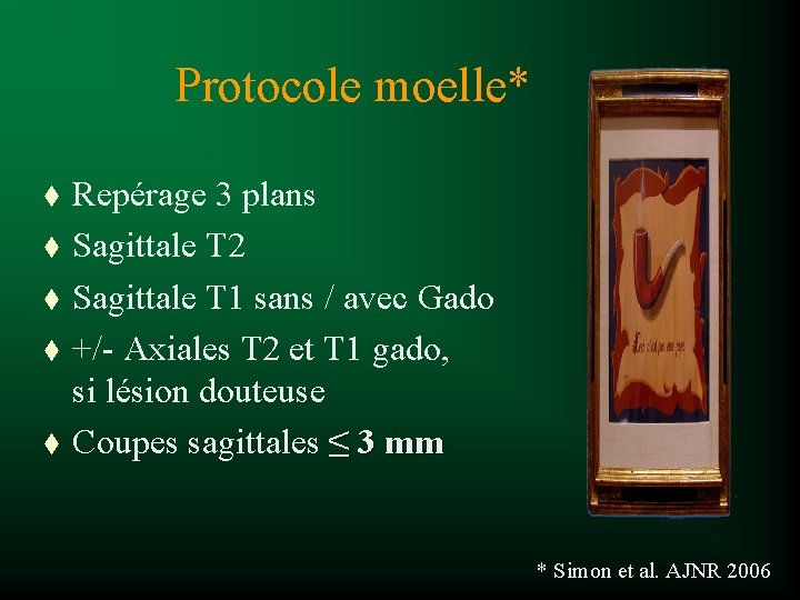 Protocole moelle* t t t Repérage 3 plans Sagittale T 2 Sagittale T 1