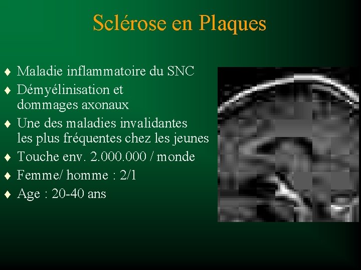 Sclérose en Plaques t t t Maladie inflammatoire du SNC Démyélinisation et dommages axonaux