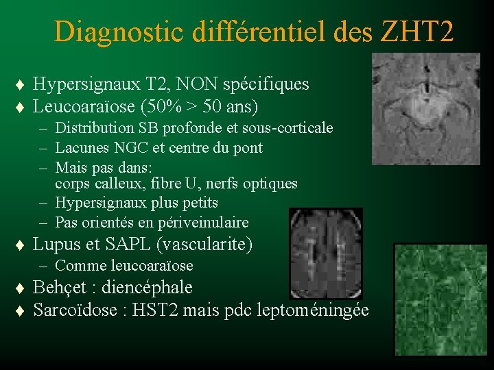Diagnostic différentiel des ZHT 2 t t Hypersignaux T 2, NON spécifiques Leucoaraïose (50%