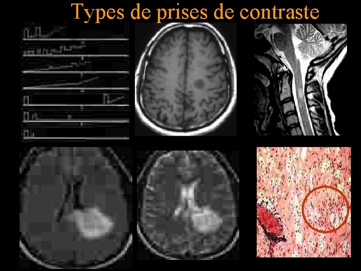 Types de prises de contraste 