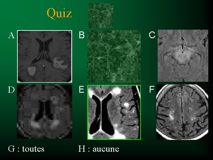 Quiz A B C D E F G : toutes H : aucune 