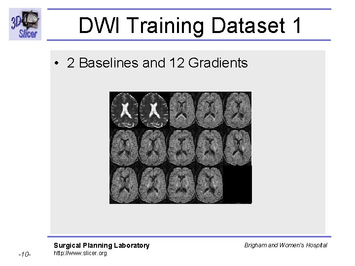 DWI Training Dataset 1 • 2 Baselines and 12 Gradients Surgical Planning Laboratory -10
